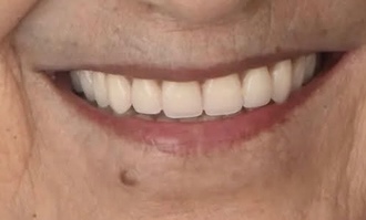 Nouveau sourire, nouvelle vie - Transformation 1